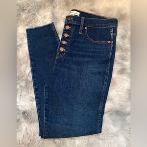 Madewell 10” High-rise Skinny Jeans
